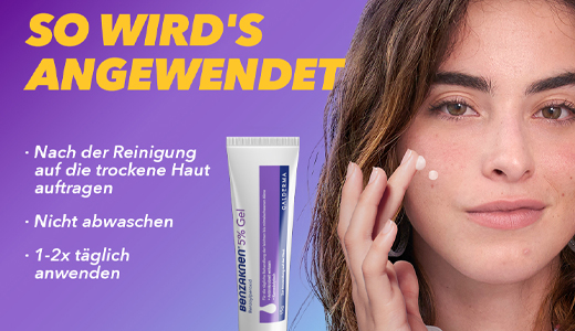 BENZAKNEN 5% geel, 15 ml