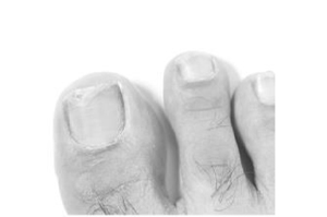 TERBINAFIN-1A Pharma Nagell.g.Nagelpilz 78,22mg/ml, 6,6 ml