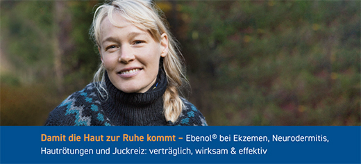 EBENOL 0,5% kreem, 30 g