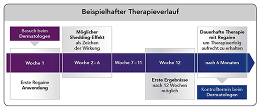 REGAINE Naiste vaht 50 mg/g, 2X60 g