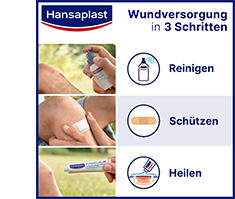 HANSAPLAST Fikseerimisside isekleepuv.6 cmx4 m sinine, 1 tk