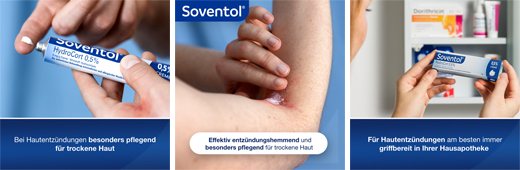 SOVENTOL Hydrocort 0,5% kreem, 15 g