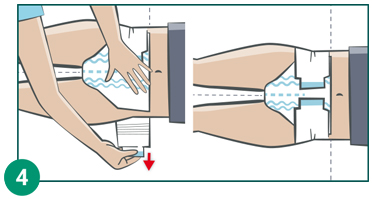 MOLICARE Premium Elastic Slip 6 tilka suurus L, 30 tk