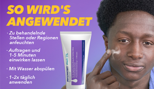 BENZAKNEN 5-protsendiline pesususpensioon, 100 g