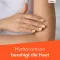 HYDROCORTISON-ratiopharm 0,5% sprei, 30 ml