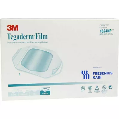 Tegaderm kile 6x7cm 1624NP, 5 tk