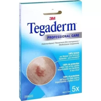 TEGADERM 3M kile 6x7 cm 1624NP, 5 tk