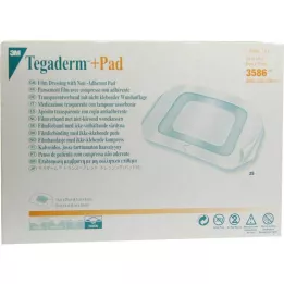 TEGADERM 3M Plus Pad 9x10 cm Valmis 3586, 25 tk