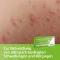 CETIRIZIN axicur 10 mg õhukese polümeerikattega tabletid, 50 tk